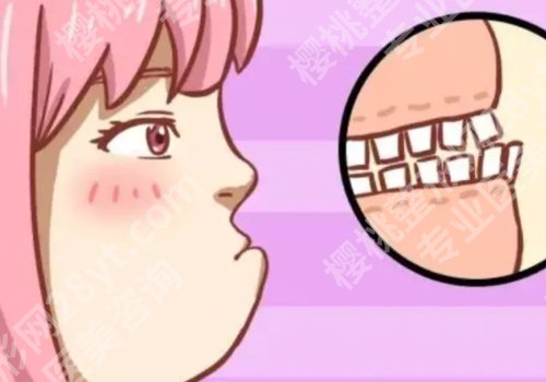 月亮脸矫正手术多少钱？手术怎么做？有哪些后遗症？