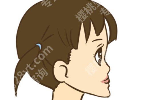 月亮脸矫正手术多少钱？手术怎么做？有哪些后遗症？