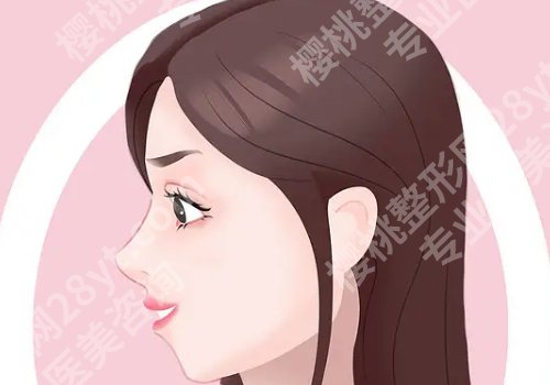 月亮脸矫正手术多少钱？手术怎么做？有哪些后遗症？