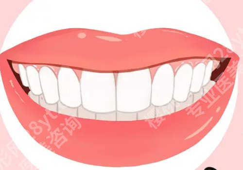 牙结石去除多少钱？有哪些影响价格因素？