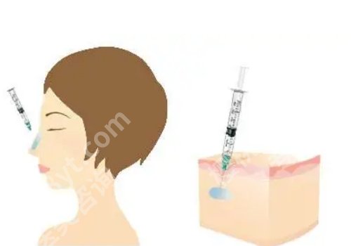 爱贝芙缺点和后遗症有哪些？这些状况你了解吗？