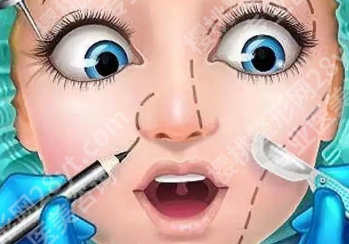 面部整形项目有哪些？面部整形方式都有哪些？