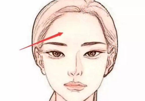 额头适合填充什么牌子玻尿酸？这些品牌有你熟悉的吗？