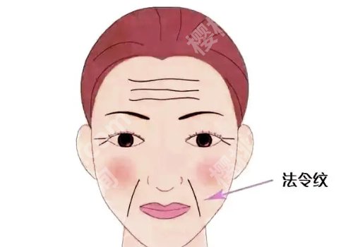 筋膜悬吊面部提升术价格上海是多少？价格影响因素有哪些？