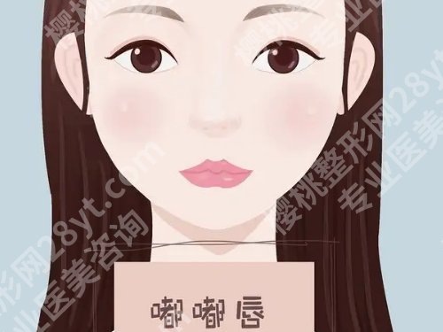 玻尿酸丰唇多久消肿？玻尿酸丰唇科普大盘点