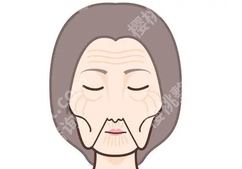 皮肤松弛怎么办如何变紧致面部？这些方法都适用于不同人群