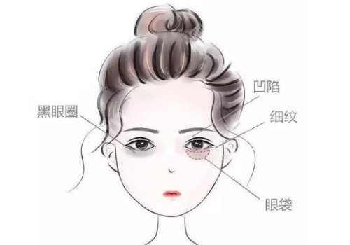 眼窝凹陷用什么填充好？手术详情一览