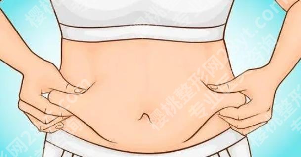 腰腹环吸包括哪几个部位？价格如何？恢复期是多久