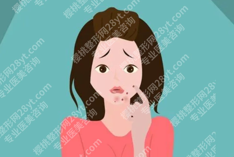 口周围长痘痘是什么原因？具体的调节方式有哪些呢？