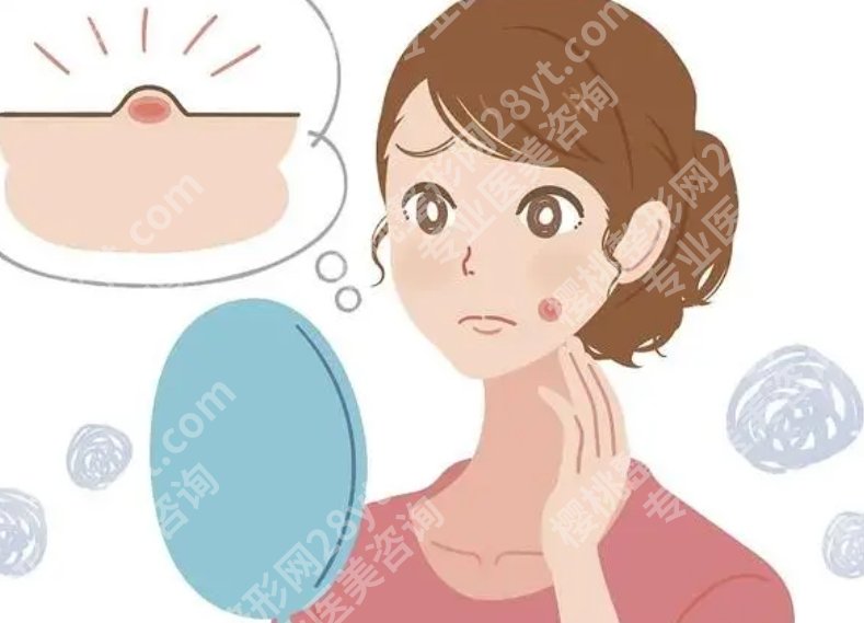 口周围长痘痘是什么原因？具体的调节方式有哪些呢？