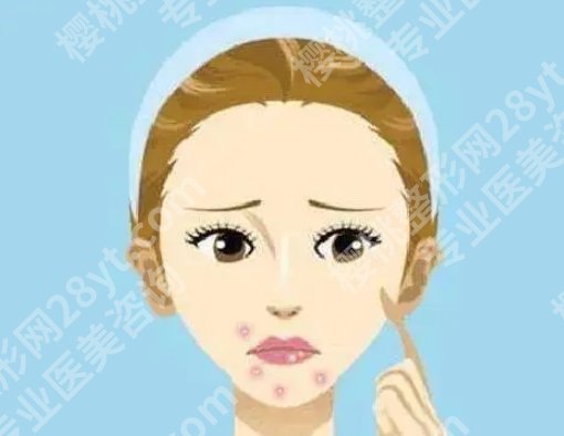 口周围长痘痘是什么原因？具体的调节方式有哪些呢？