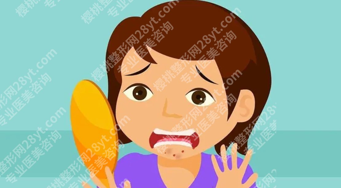 口周围长痘痘是什么原因？具体的调节方式有哪些呢？