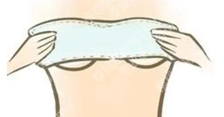 玻尿酸丰胸需要多少钱？收费的标准是什么？隆胸项目咨询