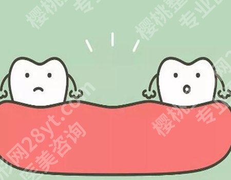 牙烂到什么程度要根管调节？调节取决于牙齿的病情和病变程度！