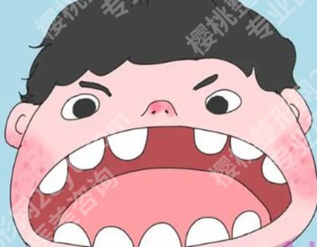 牙没了一定要种牙吗？对于是否要进行牙齿种植没有一定的答案！