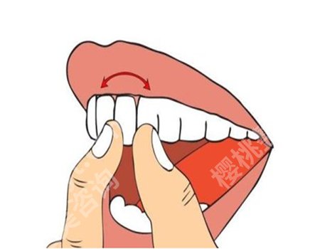 牙石简单的清除方式是什么？定期进行牙齿的清洁很重要！