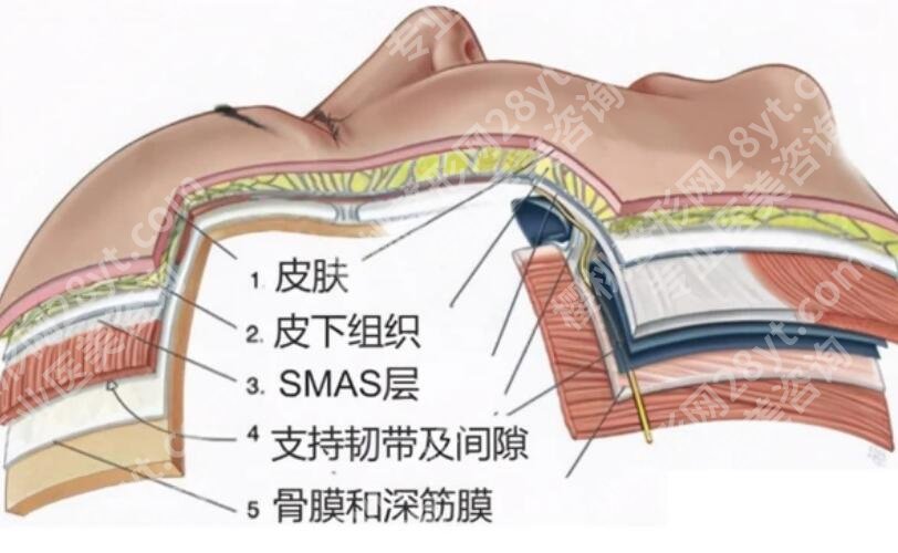 筋膜悬吊术适合多大年龄的？大概需要多少钱？有什么作用吗？