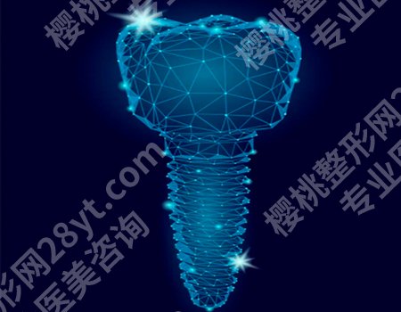 种植牙的全部过程是怎么样的？手术之前会进行ma处理！