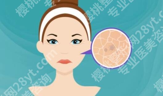 面部筋膜提升术能保持多久？效果好不好？术后恢复期是多久？