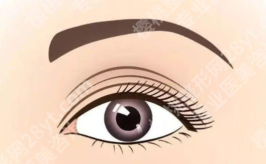 上海郑银龙整形医生做修复双眼皮怎么样?真人做眼部修复手术案例图