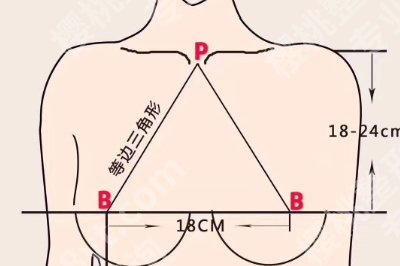 胸型外扩怎么矫正？矫正方法有哪些？维持时间介绍