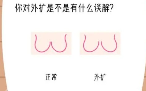 胸型外扩怎么矫正？矫正方法有哪些？维持时间介绍