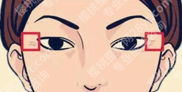 眼周抗衰项目有哪些？有什么好处？这些你一定要知道！