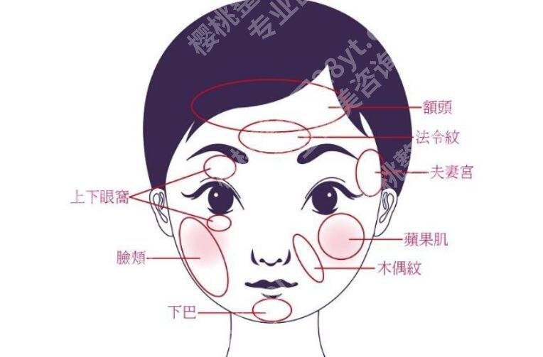 胶原蛋白注射脸部效果如何？会出现哪些副作用？