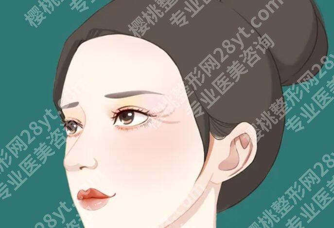 轮廓固定能保持多久？有哪些优势？附手术原理介绍！