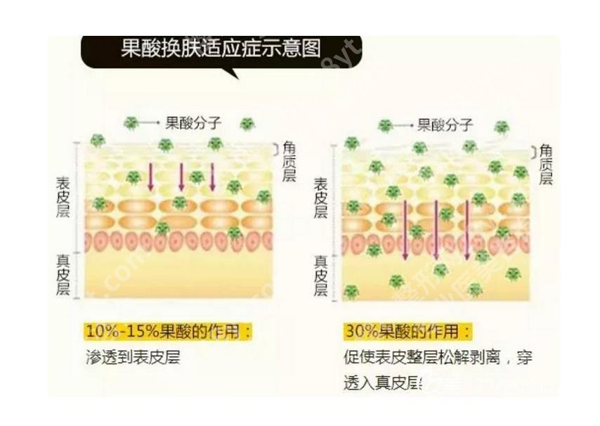 下巴长痘痘是什么原因？3个有效的解决方法揭秘
