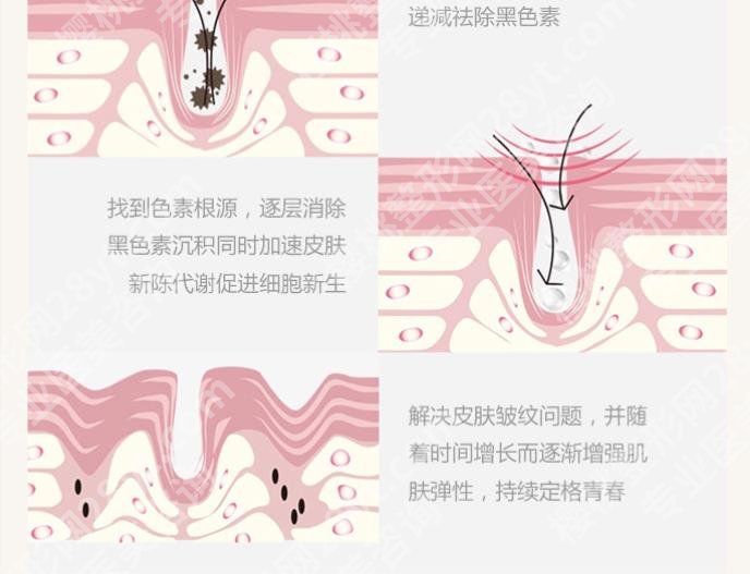 下巴长痘痘是什么原因？3个有效的解决方法揭秘