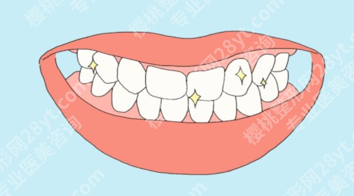 洗牙齿有什么好处和坏处有哪些？注意事项、价格表分享