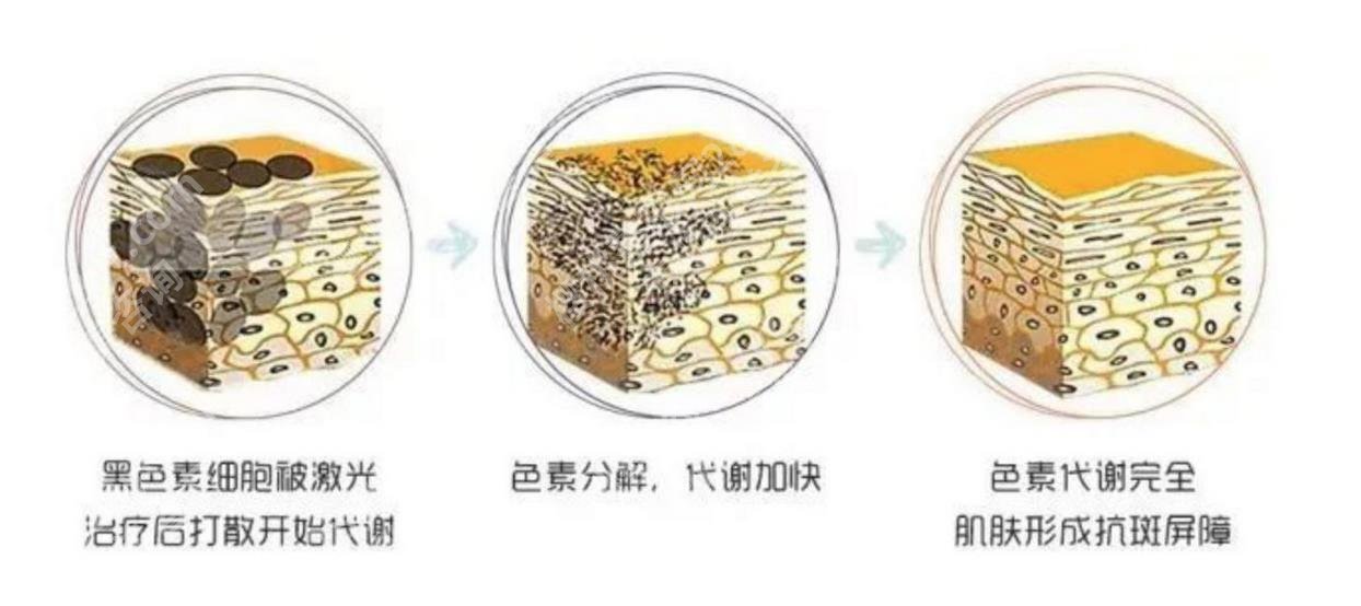 景天祛斑胶囊有什么作用？真的能祛斑吗？