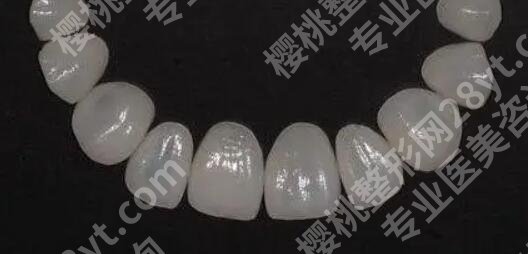 烤瓷牙的价格贵不贵？是多少？影响费用变动的因素有哪些？