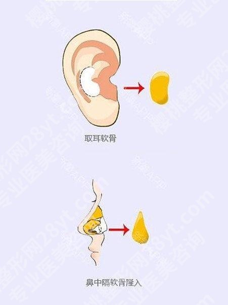 七台河人民医院隆鼻价格、整形美容科简介、案例反馈来啦!