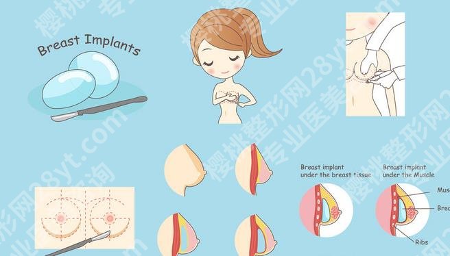 湖北省妇幼保健院隆胸多少钱?怎么样?价格表\真人案例一览