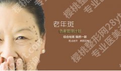 老人斑怎么去掉？5种方法分享，90%的人都说好！