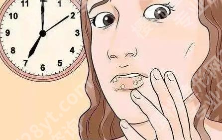 嘴唇上长水泡是什么原因引起的？几天能好？