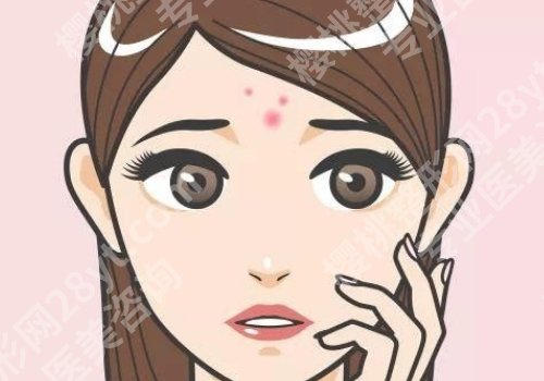 光动力调节痤疮好不好？术后怎么护理？