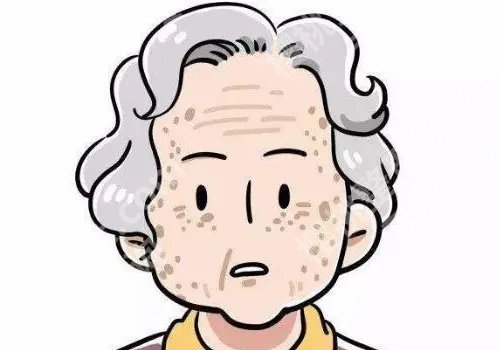 开塞露可以祛斑吗？祛斑都有哪些方式？