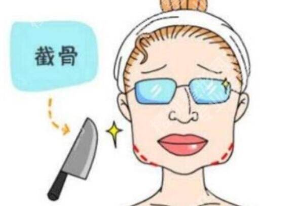 黄大勇磨骨怎么样？医生口碑点评及磨骨效果图展示！