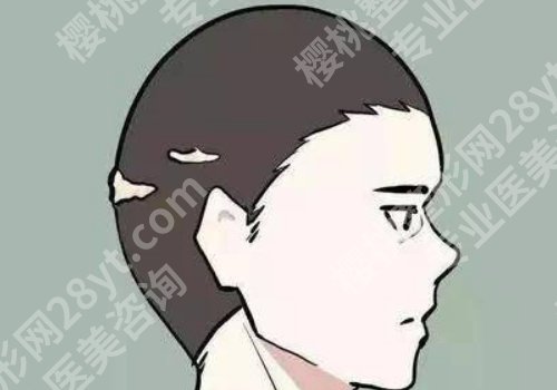 吃什么可以生发？哪种食物适合自己？