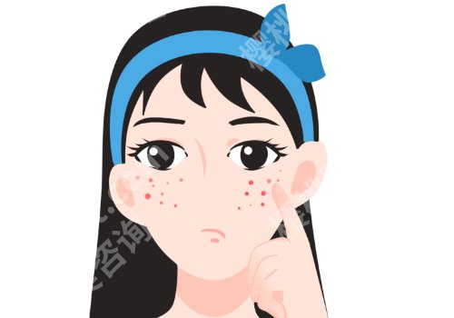 脸上有痘印怎么办？有什么小偏方？