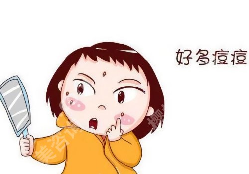 脸上有痘印怎么办？有什么小偏方？