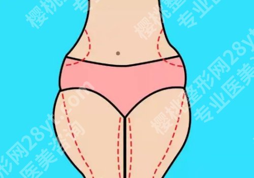 北京东方和谐吸脂怎么样？内附坐诊医生及案例介绍！