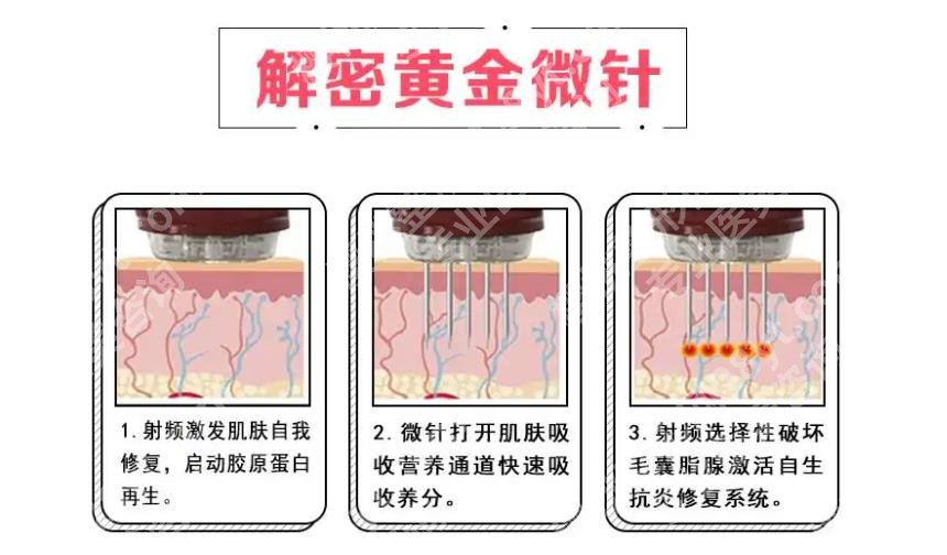 皮肤松弛怎么办？如何变紧致？网上呼声高的医美方式分享！