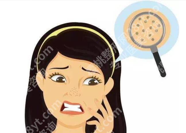 鼻子上有黑头怎么办？有什么好的方法可以去掉吗？科普知识汇总