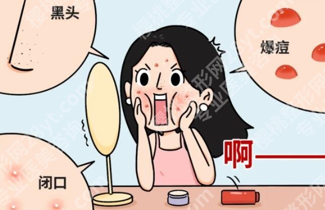 鼻子上有黑头怎么办？有什么好的方法可以去掉吗？科普知识汇总