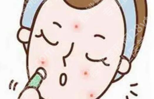 嘴角长痘痘是什么原因？有什么方法可以祛痘呢？