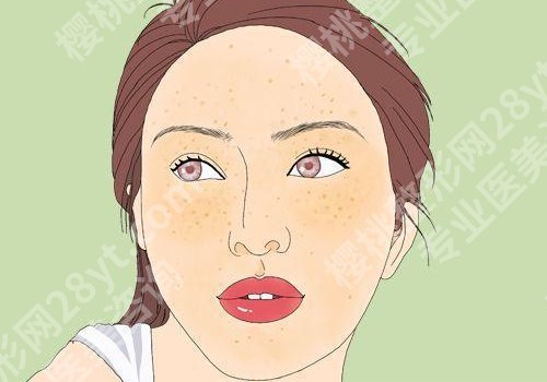 脸上长斑怎么样才能去除？都有哪些可靠的方法？